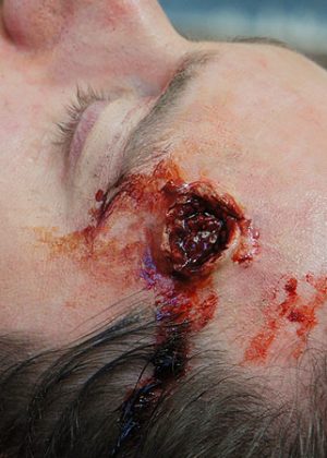 Exit Wound Prosthetic