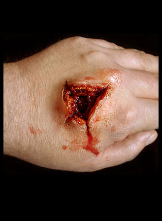 Exit Wound Prosthetic