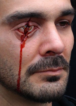 Slashed/Stabbed Eye Prosthetic