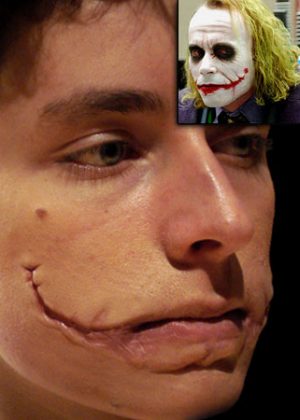 joker prosthetics