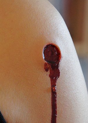 Bullet Wound Prosthetic