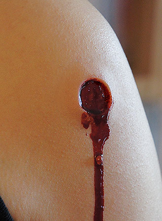 Bullet Wound Prosthetic