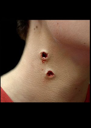 Vampire Bite Prosthetic