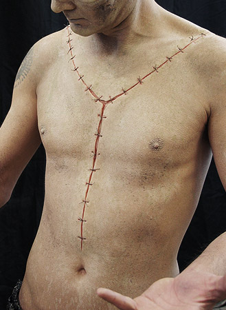 autopsy scar prosthetic