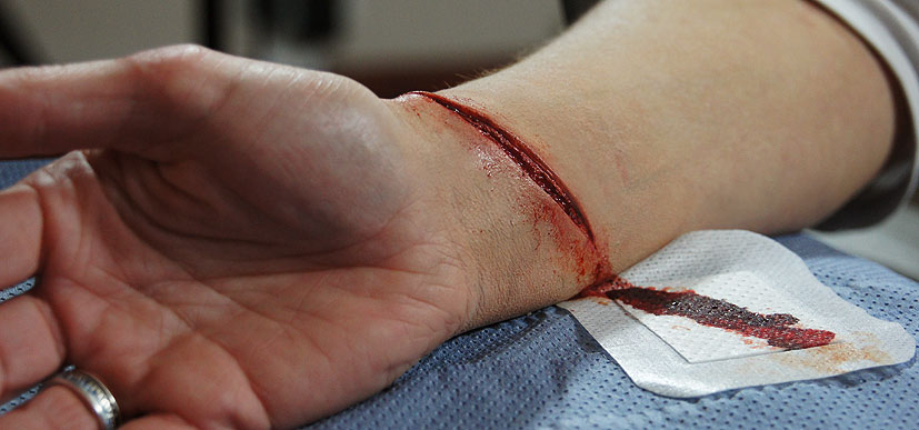 Cut Wrist Prosthetic. 
