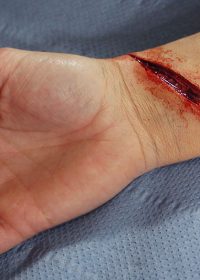 cut-wrist-prosthetic