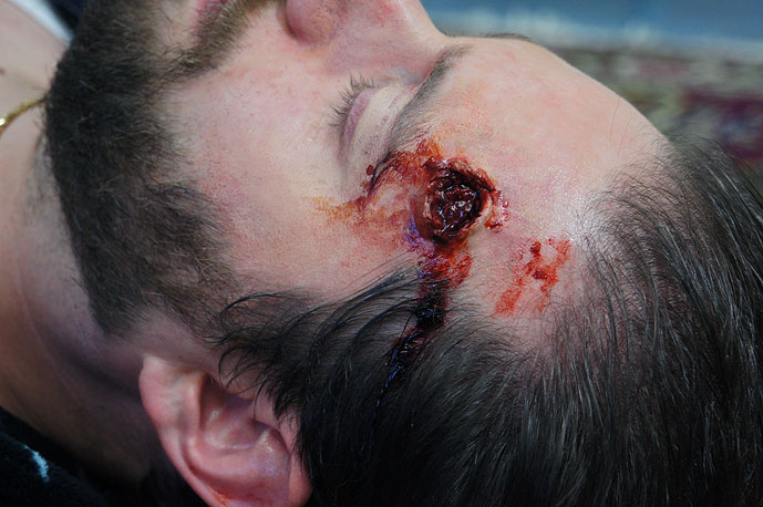 Exit Wound Prosthetic (SMALL). 
