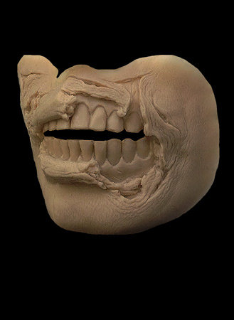 Zombie Teeth Mold - Prosthetic Transfer Material