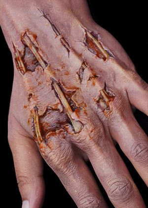 Zombie Hand Prosthetics
