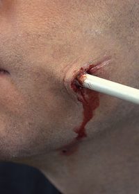 arrow wound prosthetics